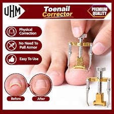 UHM Professional Ingrown Toenail Corrector Tool – Lever Pain Relief Straightener